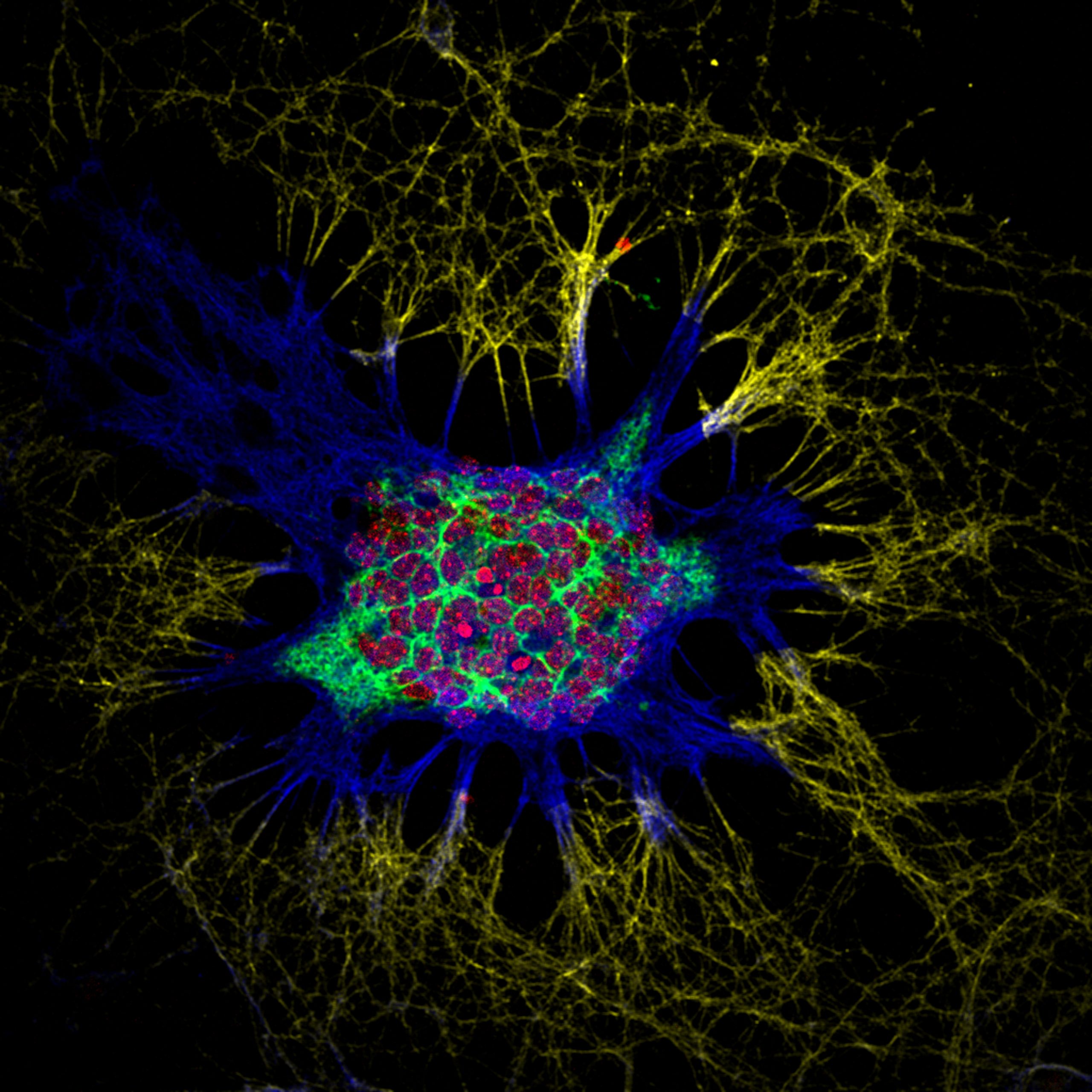 Neurone de l'hippocampe de souris