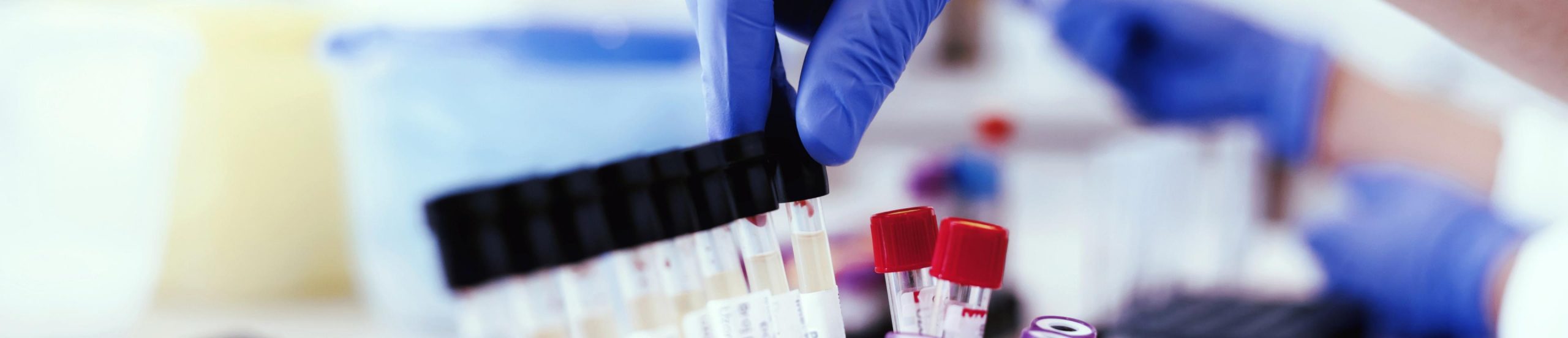 L’Inserm engagé dans le projet européen EURL-PH-VBV pour renforcer la lutte contre les virus transmis par des vecteurs